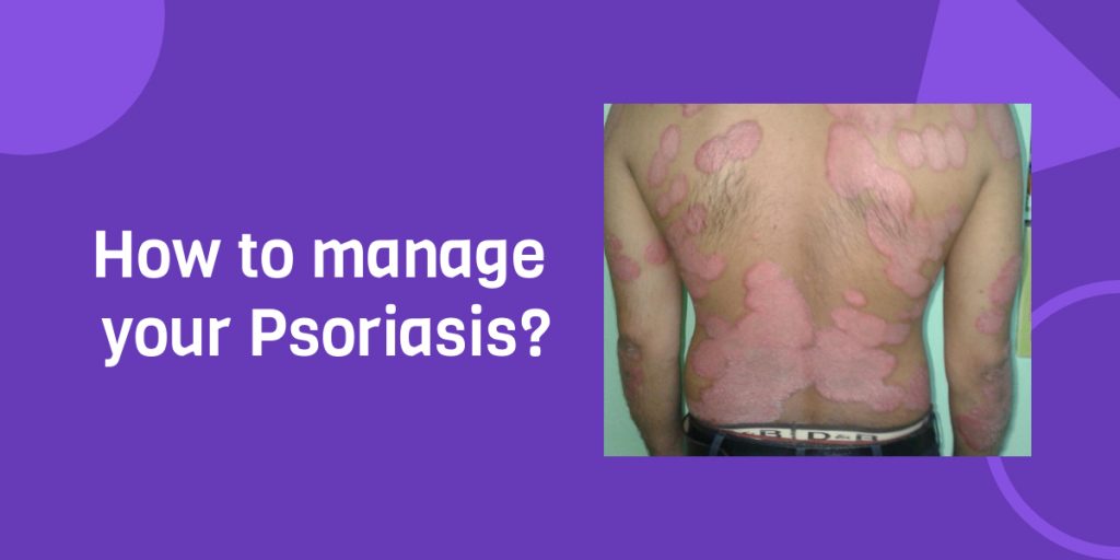 Home Remedies for Psoriasis Total Ayurveda Ayurvedic Clinic