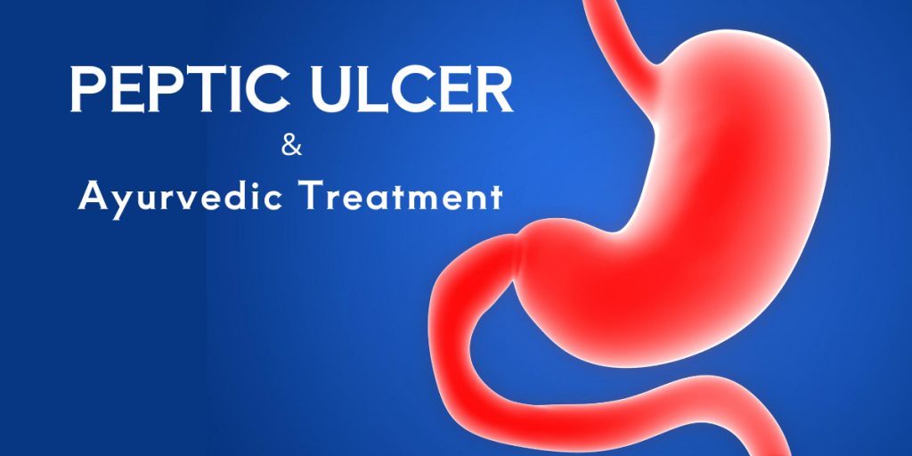 Ayurvedic Peptic Ulcer Treatment Total Ayurveda