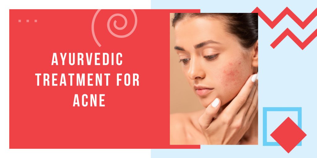 Ayurvedic Treatment For Acne Causes, Symptoms And Treatment Of Acne