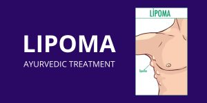 Ayurvedic Treatment for Lipoma