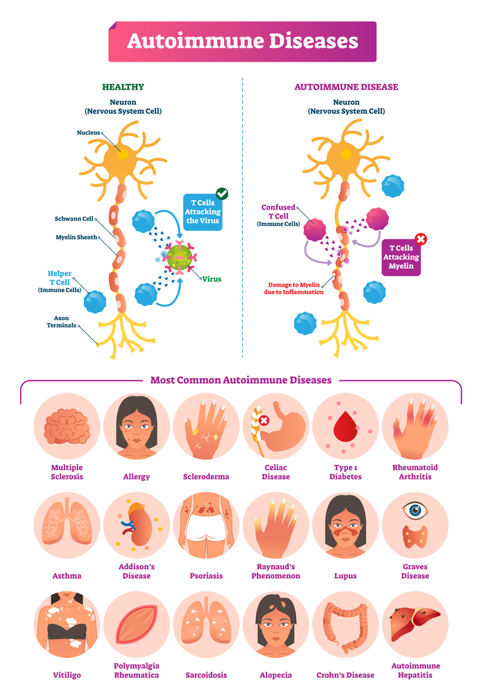 Ayurvedic Treatment for autoimmune disease.jpg