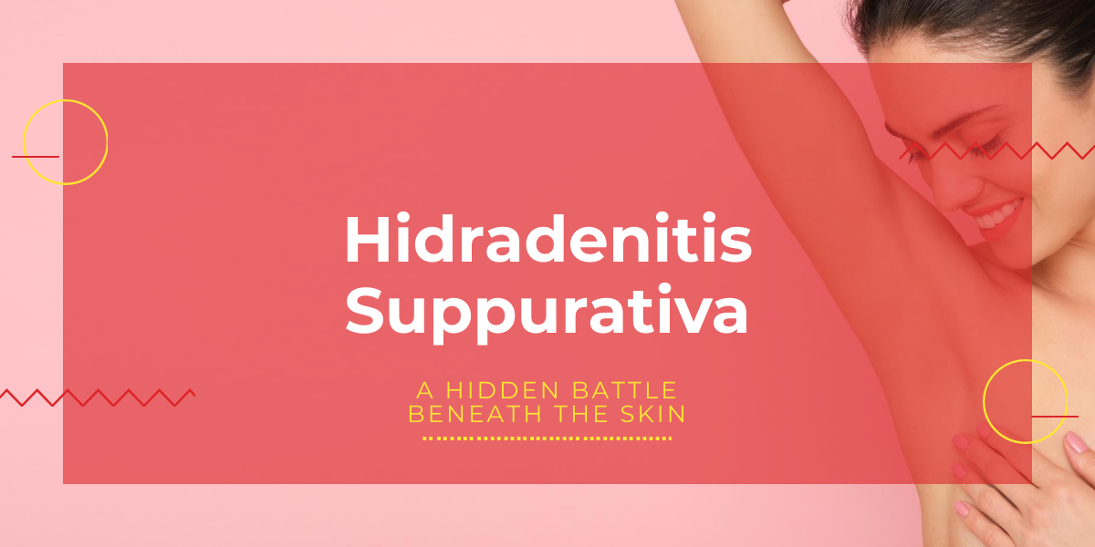 Hidradenitis suppurativa treatment