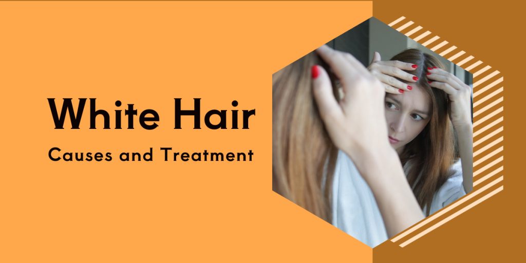 White Hair Causes And Treatment