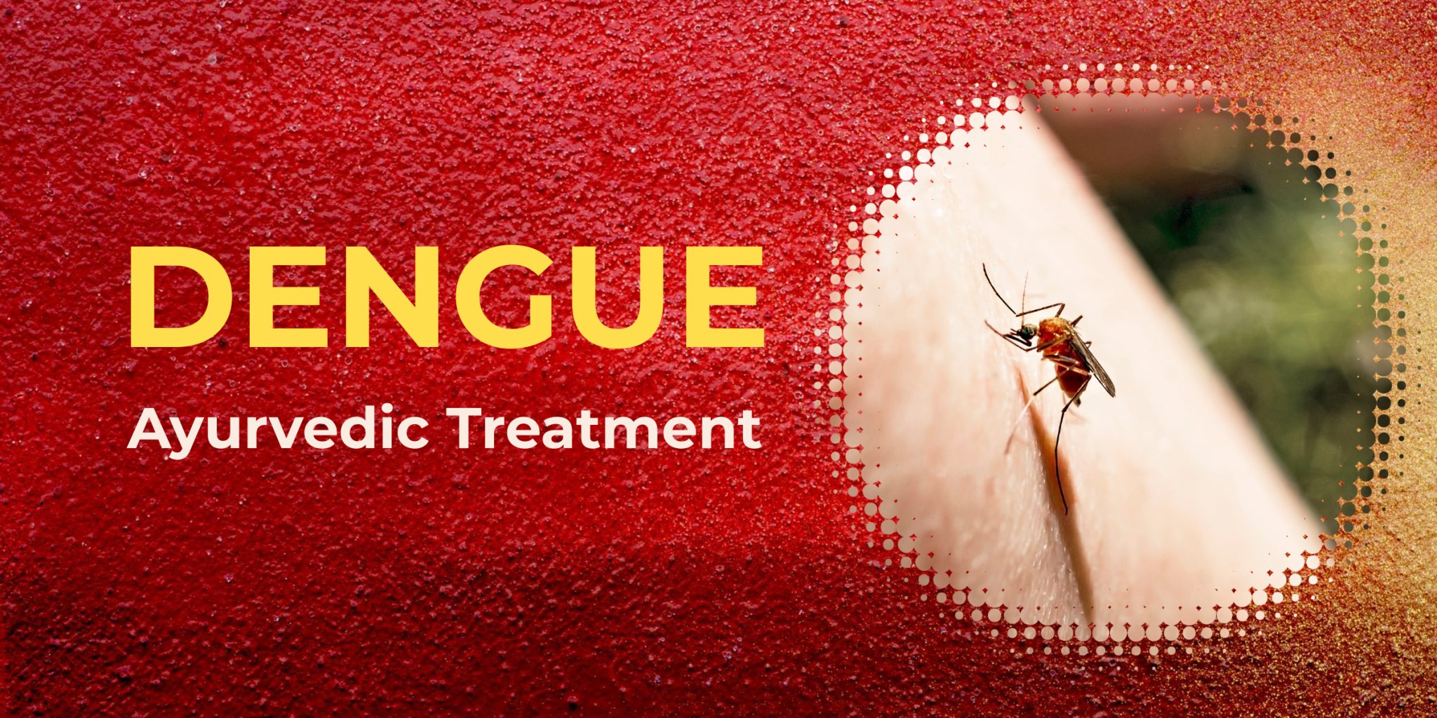 Dengue Treatment Total Ayurveda Ayurvedic Clinic Ayurvedic