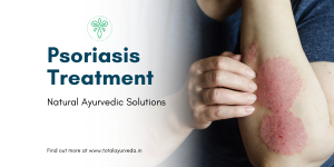 Psoriasis Treatment